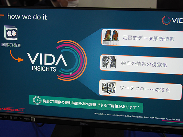 胸部CT画像から定量的データ解析などを行える「VIDA Insights」（クレアボ・テクノロジーズ社）