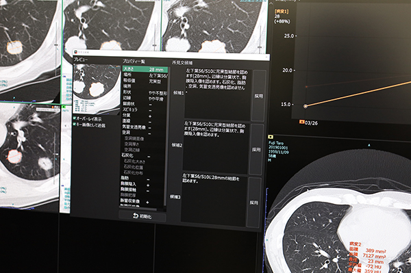 胸部CT画像の肺結節の検出結果から所見文候補を表示して所見作成を支援