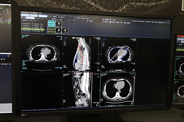 画像ビューワ「ShadeQuest/ViewR-DG」でCTなどとともに放射線治療計画画像を表示