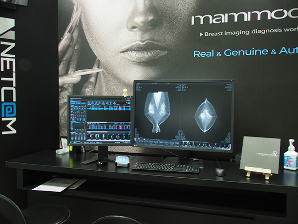 高速表示が特長の乳腺画像診断ワークステーション「mammodite」