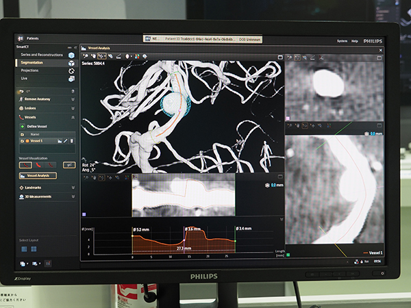 血管造影X線診断装置「Azurion」には“Smart CT”などが搭載され，スムーズな治療を実現する。