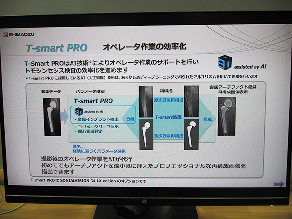 トモシンセシスアプリケーション“T-smart PRO”