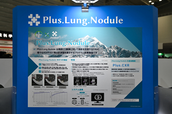 CT値が上昇した箇所を関心領域としてマーキングする「Plus.Lung.Nodule」