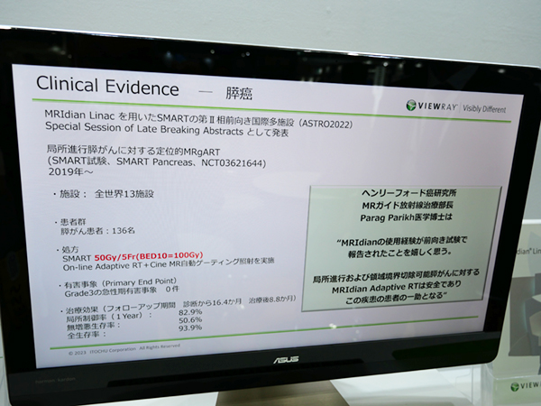 膵がんに対する定位的MRガイド下ART（SMART）第Ⅱ相前向き国際多施設試験