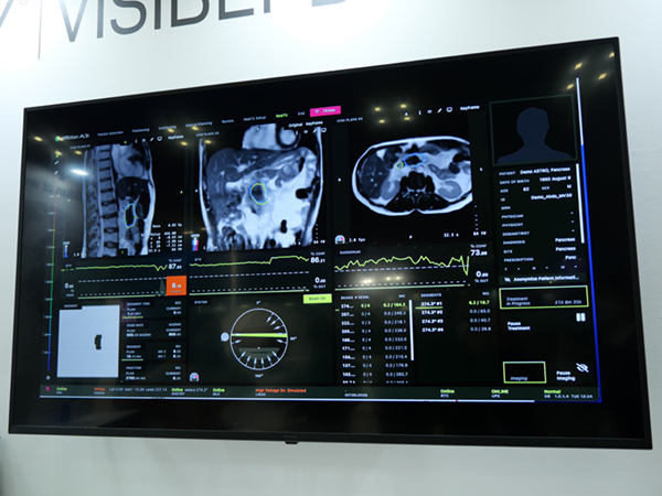 サジタル，アキシャル，コロナルの3断面でのリアルタイムゲーティングが可能になる