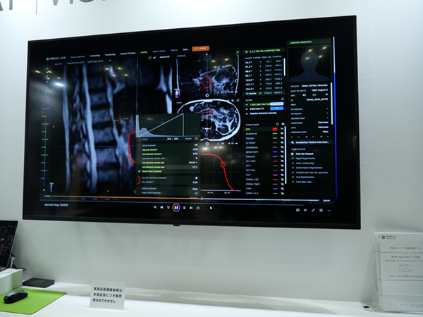 MRIdian Linacの次のシステムである「A3i」（薬機法未承認）