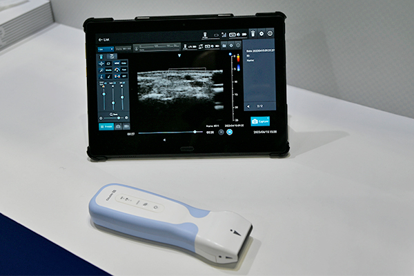 小型・軽量モバイル超音波診断装置「ECHOMO」はBモードとカラーモードに対応