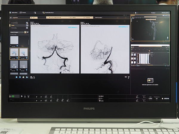 血管撮影装置「Azurion」のワークステーション