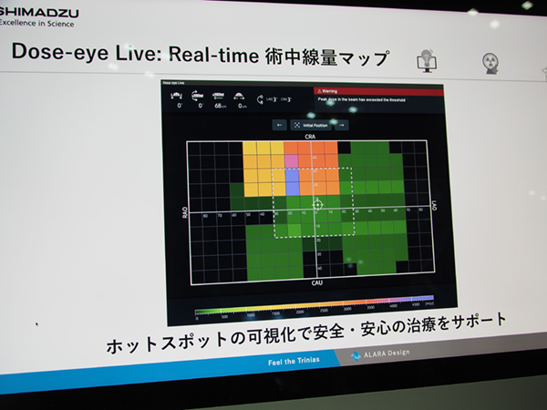 視覚的に把握しやすいリアルタイム術中線量マップ「Dose-eye Live」