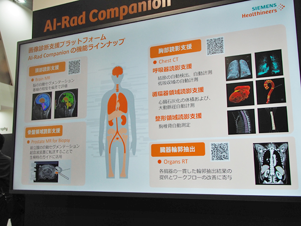 4つのラインアップを紹介した「AI-Rad Companion」
