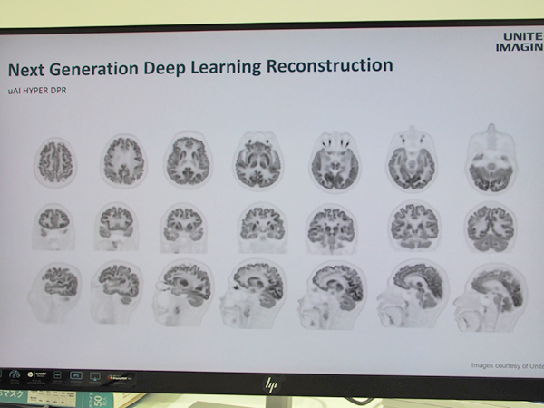 Hyper DPRでは明瞭な脳FDG-PET画像を撮像可能