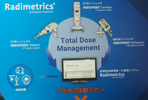 医療放射線情報と造影検査情報の一元管理を可能にする「Total Dose Management」