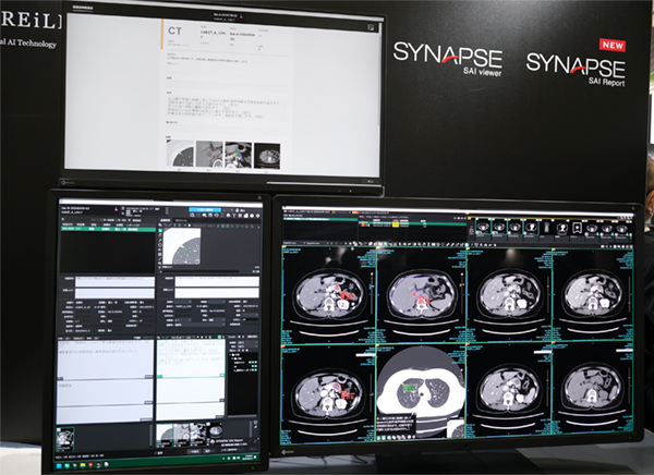 「SYNAPSE SAI viewer Ver2.4」と読影レポートシステム「SYNAPSE SAI Report」の連携展示