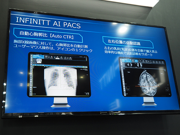 PACSビューワでは新たに心胸郭比（CTR）の自動計測機能（Auto CTR）や乳房の左右位置の自動認識機能を実装
