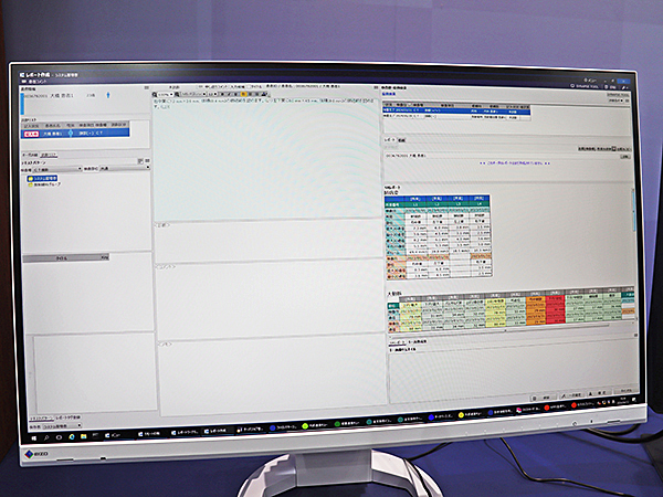 「iRad-RW」と「AI-Rad Companion（AIRC）」の連携を紹介