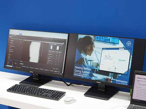 線量管理システム「Radimetrics」。Centargoと接続し，造影剤量を管理することで造影剤量の低減などを可視化できる。