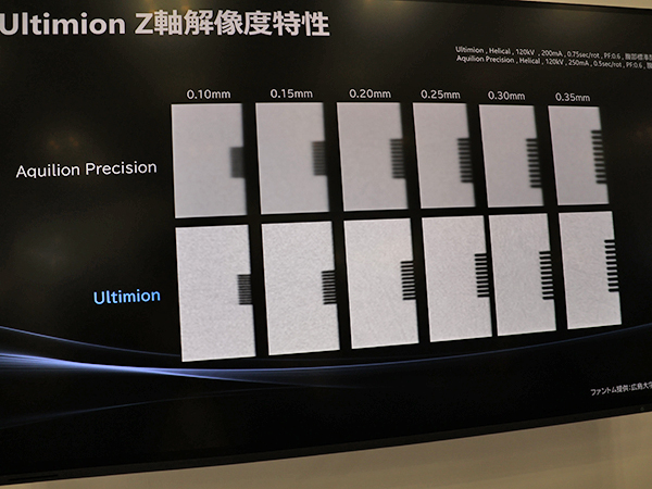 「Aquilion Precision」（上）と比べても高いZ軸解像度特性を有するUltimion（下）
