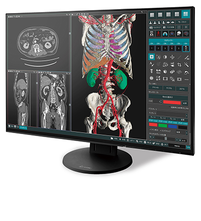 医用画像解析3Dワークステーション「Abierto Vision」