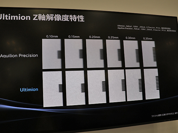 高精細CT「Aquilion Precision」（上）と比べても高いZ軸解像度特性を有するUltimion（下）