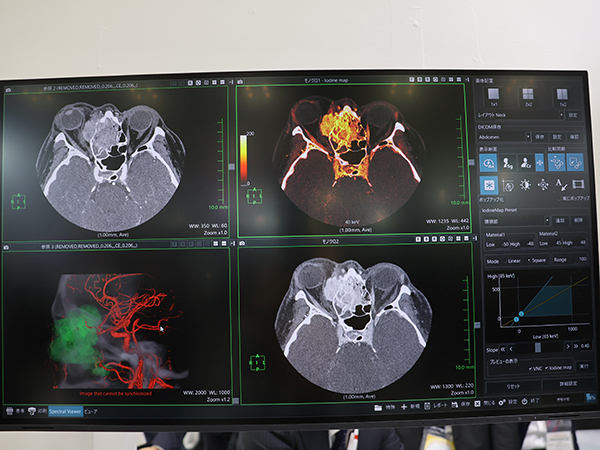 Ultimionの発売に合わせてリリースされた「Abierto Vision」の「Spectral Viewer」