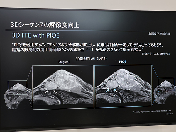 ソフトウエア「Ver.12」ではPIQEが3Dシーケンスにも適用拡大