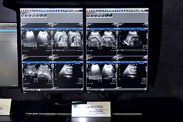 環境光と品質管理の重要性を体験できる読影支援コーナー