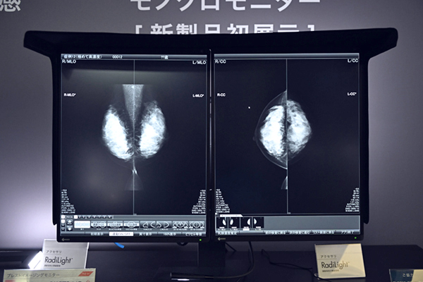 21.3型5MPのマンモグラフィ・トモシンセシス専用モニター「RadiForce GX570」