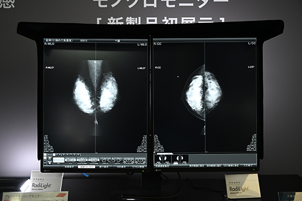 乳腺画像診断の高度なニーズに応える21.3型5MPモノクロモニター「RadiForce GX570」