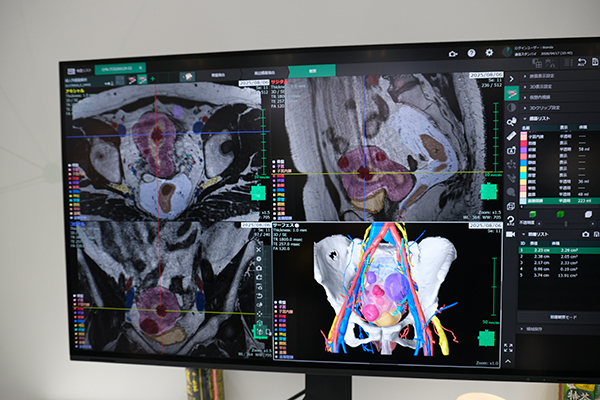 婦人科臓器解析
