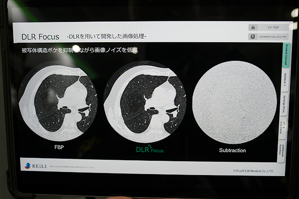 新たにDeep Learningを設計段階で用いた「DLR Focus」を搭載
