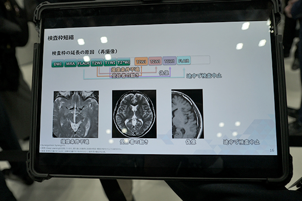 AIを活用して画像解析やワークフローの効率化を支援