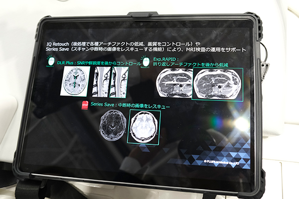 後処理で各種アーチファクトの低減やノイズ除去を行う「IQ Retouch」