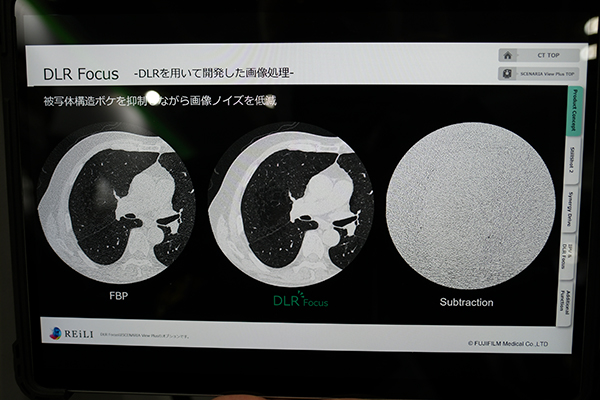 新たにDeep Learningを設計段階で用いた「DLR Focus」を搭載