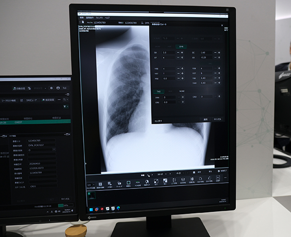 FCRパラメータ処理機能を搭載してRADISTA QAで調整が可能