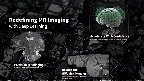 MR「New DL Solutions」