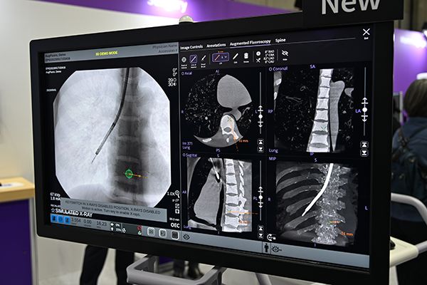 呼吸器手術向けのアプリケーションとして「Lung Suite」を用意