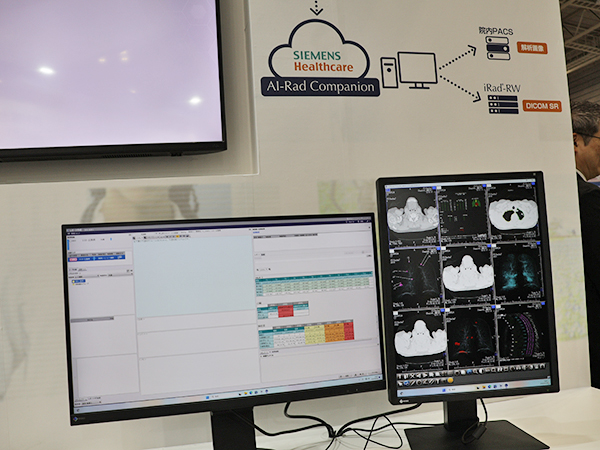 画像診断支援AIの解析結果を効率的に読影に活用するための機能をアピール