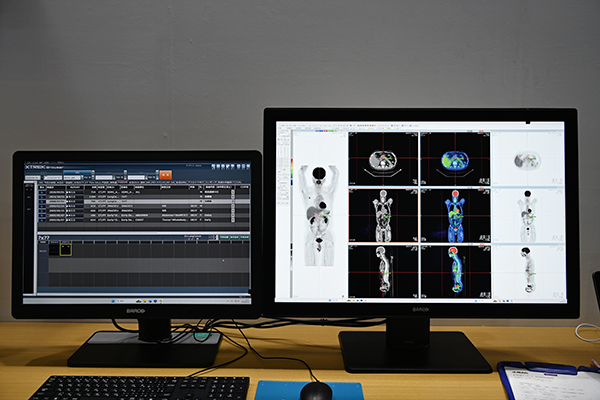 自動処理により検査後の画像処理や読影時の画像解析を省力化する「FUSION Plus」
