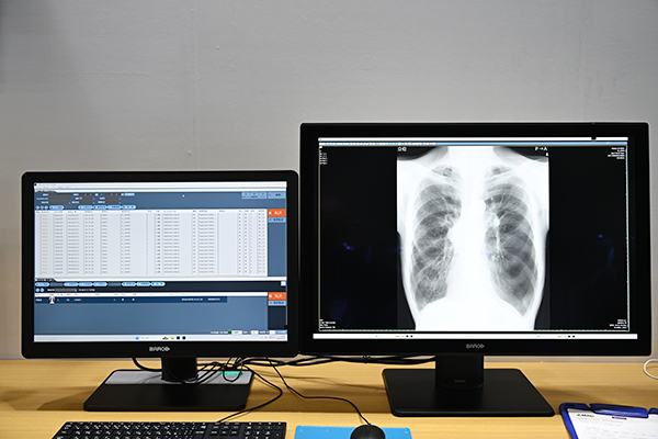 「XTREK QA」は自動処理機能を強化