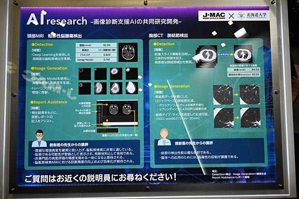 北海道大学との画像診断支援AIの共同研究を紹介