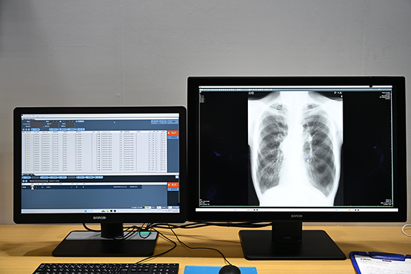 自動処理機能により検像業務の効率化を図れる検像システム「XTREK QA ADVAN」