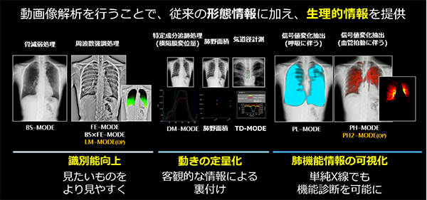 X線動態撮影システム