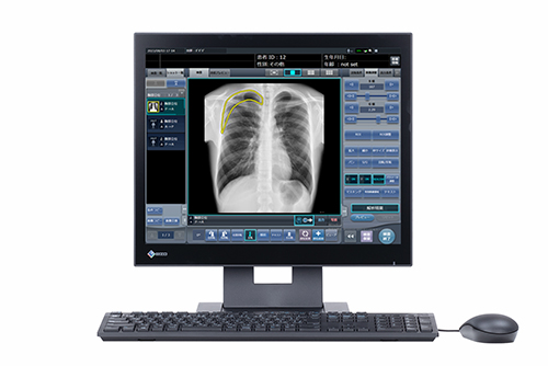 STAT画像所見報告支援『STAT Link』