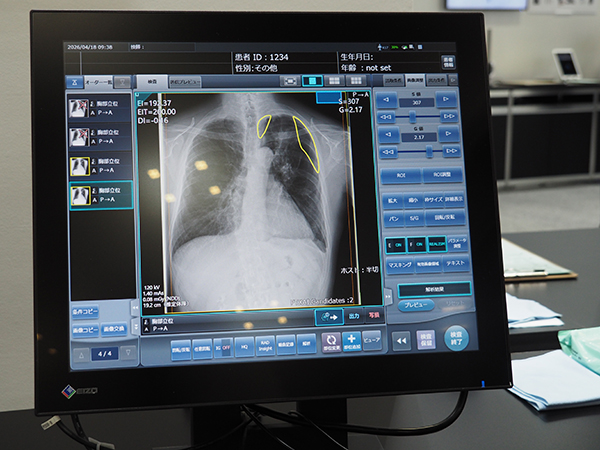 STAT Linkで検出された気胸疑い症例