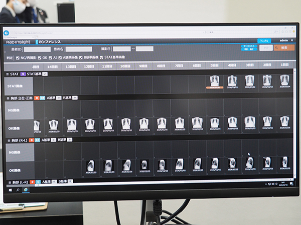 RADInsightと連携し，過去の報告実績などを確認できる。
