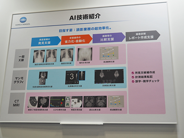読影業務のさらなる効率化をめざすAI技術を紹介。水色は実用化ずみ，ピンクは開発中の領域を示す。