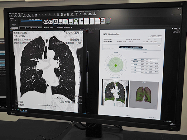 COPD解析支援機能のイメージ