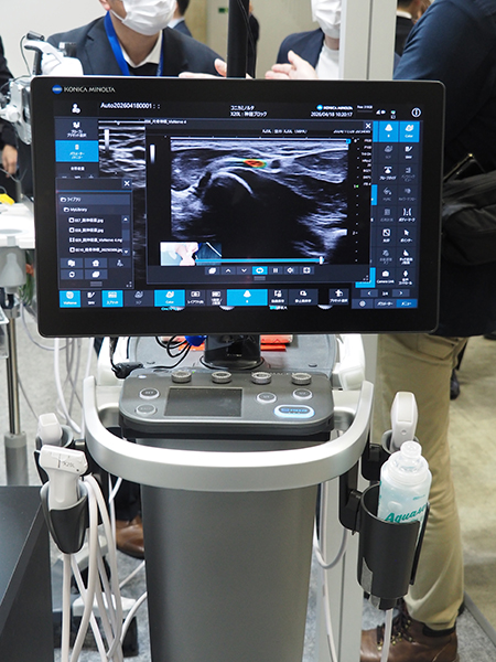 超音波診断装置「SONIMAGE UX1」。プローブ1本で幅広い検査に使用できる。