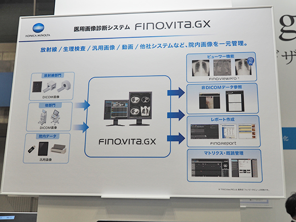 医用画像診断システム「FINO.VITA.GX」のイメージ