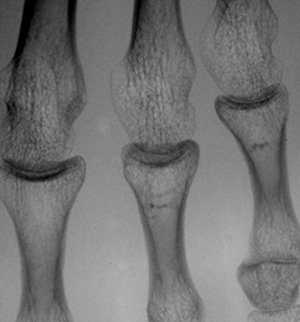 ピクセル・アラインド・グリッド （66.8本/cm，0.15mm間隔）信号消失がまったくありません